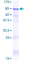 TINAG / TIN-AG Protein - 12.5% SDS-PAGE of human TINAG stained with Coomassie Blue