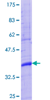 TINAG / TIN-AG Protein - 12.5% SDS-PAGE Stained with Coomassie Blue.