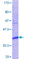 TINAG / TIN-AG Protein - 12.5% SDS-PAGE Stained with Coomassie Blue.