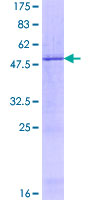 TINAGL1 / Lipocalin 7 Protein - 12.5% SDS-PAGE of human TINAGL1 stained with Coomassie Blue