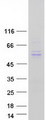 TINAGL1 / Lipocalin 7 Protein - Purified recombinant protein TINAGL1 was analyzed by SDS-PAGE gel and Coomassie Blue Staining