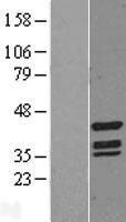 TINF2 Protein - Western validation with an anti-DDK antibody * L: Control HEK293 lysate R: Over-expression lysate