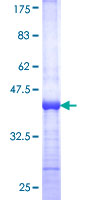 TINF2 Protein - 12.5% SDS-PAGE Stained with Coomassie Blue.