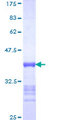 TIP120 / CAND1 Protein - 12.5% SDS-PAGE Stained with Coomassie Blue.