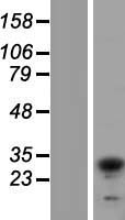 TIP30 / HTATIP2 Protein - Western validation with an anti-DDK antibody * L: Control HEK293 lysate R: Over-expression lysate
