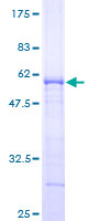 TIP30 / HTATIP2 Protein - 12.5% SDS-PAGE of human HTATIP2 stained with Coomassie Blue