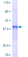 TIP30 / HTATIP2 Protein - 12.5% SDS-PAGE of human HTATIP2 stained with Coomassie Blue