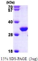 TIP30 / HTATIP2 Protein