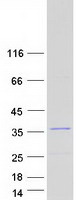 TIP30 / HTATIP2 Protein - Purified recombinant protein HTATIP2 was analyzed by SDS-PAGE gel and Coomassie Blue Staining