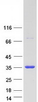 TIP30 / HTATIP2 Protein - Purified recombinant protein HTATIP2 was analyzed by SDS-PAGE gel and Coomassie Blue Staining