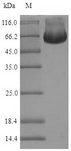 TIP48 / RUVBL2 Protein - (Tris-Glycine gel) Discontinuous SDS-PAGE (reduced) with 5% enrichment gel and 15% separation gel.