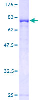 TIP49 / RUVBL1 Protein - 12.5% SDS-PAGE of human RUVBL1 stained with Coomassie Blue