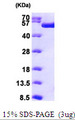 TIP49 / RUVBL1 Protein