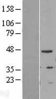 TIPIN Protein - Western validation with an anti-DDK antibody * L: Control HEK293 lysate R: Over-expression lysate