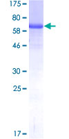 TIPIN Protein - 12.5% SDS-PAGE of human TIPIN stained with Coomassie Blue