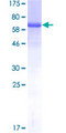 TIPIN Protein - 12.5% SDS-PAGE of human TIPIN stained with Coomassie Blue