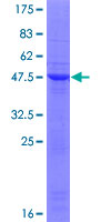 TIPRL / TIP Protein - 12.5% SDS-PAGE of human TIPRL stained with Coomassie Blue
