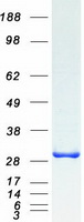 TIPRL / TIP Protein - Purified recombinant protein TIPRL was analyzed by SDS-PAGE gel and Coomassie Blue Staining