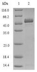 TIRAP Protein - (Tris-Glycine gel) Discontinuous SDS-PAGE (reduced) with 5% enrichment gel and 15% separation gel.