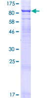 TIRC7 / TCIRG1 Protein - 12.5% SDS-PAGE of human TCIRG1 stained with Coomassie Blue