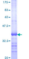 TIRC7 / TCIRG1 Protein - 12.5% SDS-PAGE Stained with Coomassie Blue.