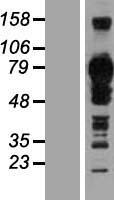 TJAP1 Protein - Western validation with an anti-DDK antibody * L: Control HEK293 lysate R: Over-expression lysate