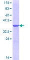 TJAP1 Protein - 12.5% SDS-PAGE Stained with Coomassie Blue.