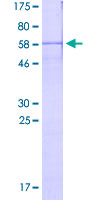 TJP1 / ZO-1 Protein - 12.5% SDS-PAGE Stained with Coomassie Blue.