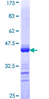 TJP2 / ZO2 / ZO-2 Protein - 12.5% SDS-PAGE Stained with Coomassie Blue.