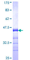TJP3 / ZO3 Protein - 12.5% SDS-PAGE Stained with Coomassie Blue.