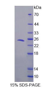 TJP3 / ZO3 Protein - Recombinant Tight Junction Protein 3 (TJP3) by SDS-PAGE