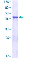TK1 / TK / Thymidine Kinase Protein - 12.5% SDS-PAGE of human TK1 stained with Coomassie Blue