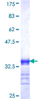 TK1 / TK / Thymidine Kinase Protein - 12.5% SDS-PAGE Stained with Coomassie Blue.