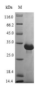 TK2 Protein - (Tris-Glycine gel) Discontinuous SDS-PAGE (reduced) with 5% enrichment gel and 15% separation gel.