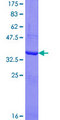 TK2 Protein - 12.5% SDS-PAGE Stained with Coomassie Blue.
