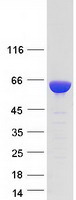 TKFC / DAK Protein - Purified recombinant protein TKFC was analyzed by SDS-PAGE gel and Coomassie Blue Staining