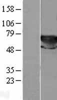 TKT / Transketolase Protein - Western validation with an anti-DDK antibody * L: Control HEK293 lysate R: Over-expression lysate