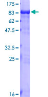 TKT / Transketolase Protein - 12.5% SDS-PAGE of human TKT stained with Coomassie Blue