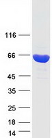 TKT / Transketolase Protein - Purified recombinant protein TKT was analyzed by SDS-PAGE gel and Coomassie Blue Staining