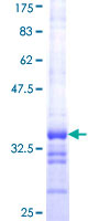 TKTL2 Protein - 12.5% SDS-PAGE Stained with Coomassie Blue.