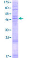 TLCD1 Protein - 12.5% SDS-PAGE of human TLCD1 stained with Coomassie Blue
