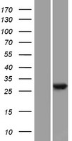 TLCD2 Protein - Western validation with an anti-DDK antibody * L: Control HEK293 lysate R: Over-expression lysate