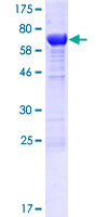 TLDC1 / KIAA1609 Protein - 12.5% SDS-PAGE of human KIAA1609 stained with Coomassie Blue