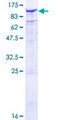 TLE2 Protein - 12.5% SDS-PAGE of human TLE2 stained with Coomassie Blue