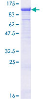 TLE3 Protein - 12.5% SDS-PAGE of human TLE3 stained with Coomassie Blue