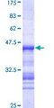 TLK2 Protein - 12.5% SDS-PAGE Stained with Coomassie Blue.