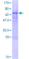 TLL1 Protein - 12.5% SDS-PAGE of human TLL1 stained with Coomassie Blue