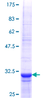 TLL1 Protein - 12.5% SDS-PAGE Stained with Coomassie Blue.
