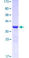TLN1 / Talin 1 Protein - 12.5% SDS-PAGE Stained with Coomassie Blue.