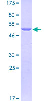 TLN1 / Talin 1 Protein - 12.5% SDS-PAGE Stained with Coomassie Blue.